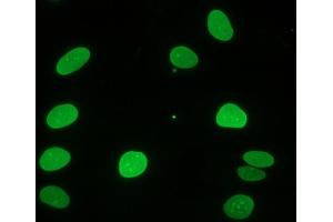 Immunocytochemical staining of fiboblasts showing nuclear lamina (Lamin A/C antibody)