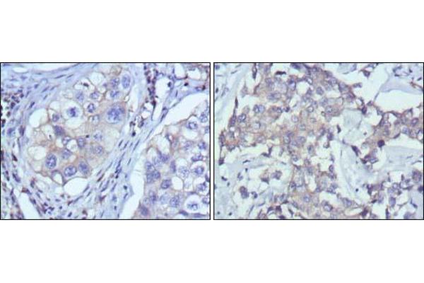 Reticulon 3 antibody