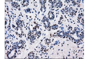 Immunohistochemical staining of paraffin-embedded breast tissue using anti-BTN3A2 mouse monoclonal antibody. (BTN3A2 antibody)