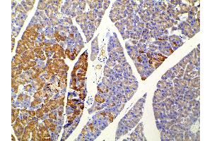 Immunohistochemistry (IHC) image for anti-Ephrin B2 (EFNB2) (C-Term) antibody (ABIN6261455)