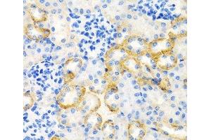 Immunohistochemistry of paraffin-embedded Rat kidney using STC1 Polyclonal Antibody at dilution of 1:100 (40x lens). (Stanniocalcin 1 antibody)