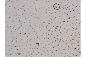 ABIN6267511 at 1/200 staining Mouse heart tissue sections by IHC-P. (STAT6 antibody  (pThr645))