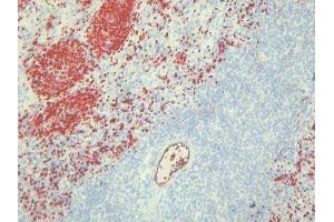 Immunohistochemistry (IHC) image for anti-Endothelial Cells antibody (ABIN781798) (Endothelial Cells antibody)