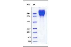HIV-1 (CN54) GP120 on SDS-PAGE under reducing (R) condition. (Human Immunodeficiency Virus Surface Glycoprotein (HIV gp120) (AA 36-507) (Active) protein (His tag))