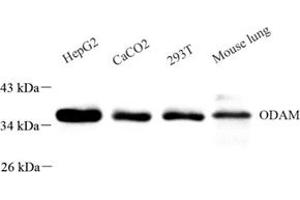 Western blot analysis of ODAM (ABIN7074940) at dilution of 1: 500