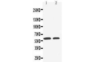 Anti-SLC22A1 antibody, Western blotting Lane 1: HELA Cell Lysate Lane 2: A549 Cell Lysate (SLC22A1 antibody  (C-Term))