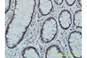 Image no. 1 for anti-Phosphoglucomutase 3 (PGM3) (AA 1-543) antibody (ABIN598868) (Phosphoglucomutase 3 antibody  (AA 1-543))
