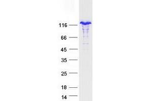 Western Blotting (WB) image for Nuclear Factor of kappa Light Polypeptide Gene Enhancer in B-Cells 2 (NFKB2) (Transcript Variant 3) protein (Myc-DYKDDDDK Tag) (ABIN2727696)