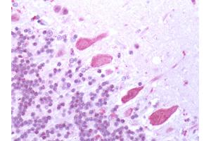 Human Brain, Cerebellum: Formalin-Fixed, Paraffin-Embedded (FFPE) (Bestrophin 3 antibody  (Cytoplasmic Domain))