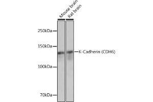 Western blot analysis of extracts of various cell lines, using K-Cadherin (CDH6) Rabbit mAb (ABIN1680831, ABIN3019147, ABIN3019148 and ABIN7101722) at 1:3000 dilution. (CDH6 antibody)