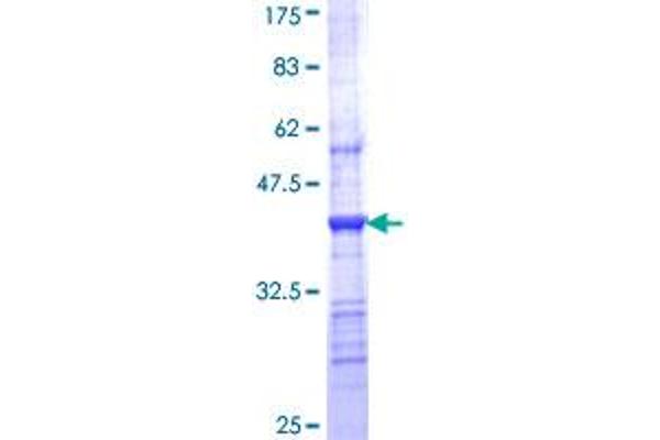 CHRNB1 Protein (AA 24-128) (GST tag)