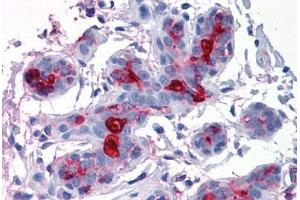 Breast, Human: Formalin-Fixed, Paraffin-Embedded (FFPE) (MUC1 antibody)