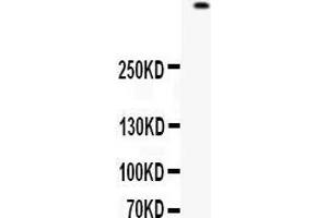 Western blot analysis of Filaggrin expression in 22RV1 whole cell lysates (lane 1). (Filaggrin antibody  (AA 1-261))