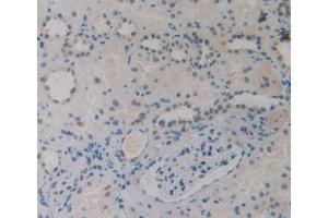 IHC-P analysis of Human Kidney Tissue, with DAB staining. (EBI3 antibody)