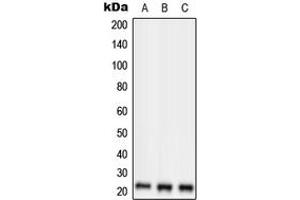 Western blot analysis of RKIP expression in HepG2 (A), SP2/0 (B), H9C2 (C) whole cell lysates. (PEBP1 antibody  (Center))