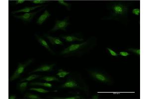 Immunofluorescence of monoclonal antibody to RPS29 on HeLa cell. (RPS29 antibody  (AA 1-56))