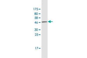 Western Blotting (WB) image for anti-Heat Shock Protein, alpha-Crystallin-Related, B6 (HSPB6) (AA 1-160) antibody (ABIN949832)