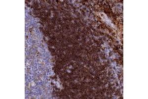 Immunohistochemical staining of human tonsil with PLAC8 polyclonal antibody  shows strong cytoplasmic positivity in lymphoid cells outside reaction centra. (PLAC8 antibody)
