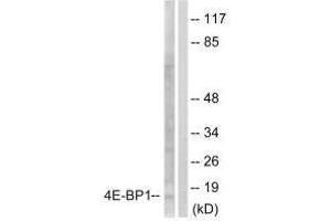Western blot analysis of extracts from Jurkat cells, treated with Insulin (0. (eIF4EBP1 antibody  (Ser65))