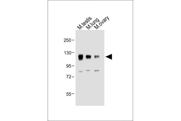 NPR1 antibody  (AA 198-226)