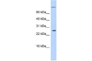 ARID5A antibody used at 0. (ARID5A antibody  (N-Term))