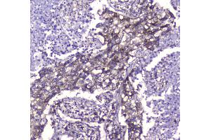 IHC analysis of CLPP using anti-CLPP antibody . (CLPP antibody  (AA 184-247))