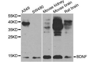 Western blot analysis of extracts of various cell lines, using BDNF antibody. (BDNF antibody  (AA 20-247))