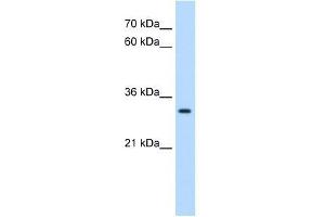 DBX2 antibody used at 0. (DBX2 antibody  (N-Term))