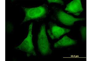 Immunofluorescence of purified MaxPab antibody to CACYBP on HeLa cell. (CACYBP antibody  (AA 1-228))