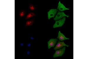 ABIN6264613 and ABIN6277733 staining  cells by IF/ICC. (RAD21 antibody  (C-Term))