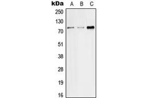 Western blot analysis of SGLT2 expression in HeLa (A), SP2/0 (B), H9C2 (C) whole cell lysates. (SLC5A2 antibody  (Center))