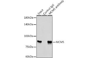 Immunoprecipitation analysis of 300 μg extracts of HeLa cells using 3 μg MCM5 antibody (ABIN6132075, ABIN6143645, ABIN6143647 and ABIN6221204). (MCM5 antibody  (AA 1-230))