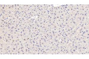 Immunohistochemistry (IHC) image for anti-Nucleolin (NCL) (AA 353-568) antibody (ABIN7434776)