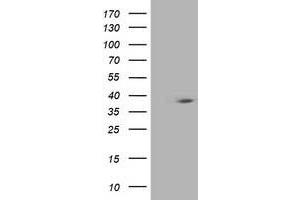 Western Blotting (WB) image for anti-HSPA Binding Protein, Cytoplasmic Cochaperone 1 (HSPBP1) antibody (ABIN1498761) (HSPBP1 antibody)