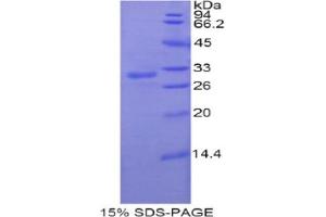 SDS-PAGE analysis of Rat PNMA2 Protein. (PNMA2 Protein)
