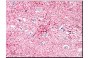 Human Brain, Basal Ganglia: Formalin-Fixed, Paraffin-Embedded (FFPE) (SLC1A4 antibody)