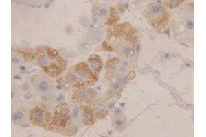 Detection of HEXb in Human Liver Tissue using Polyclonal Antibody to Hexosaminidase B Beta (HEXb) (HEXB antibody  (AA 315-456))