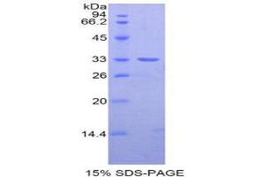 SDS-PAGE (SDS) image for Nexilin (NEXN) (AA 214-455) protein (His tag) (ABIN1877271)