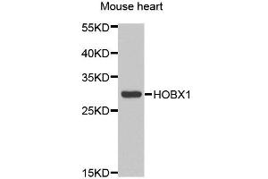Western blot analysis of extracts of Mouse heart cell line, using HOXB1 antibody.