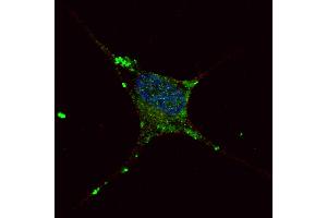 Fluorescent confocal image of SY5Y cells stained with ELP2 antibody. (ELP2 antibody  (C-Term))