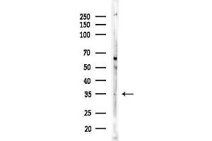 anti-Atonal Homolog 8 (ATOH8) (C-Term) antibody