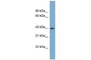ASPHD2 antibody used at 1 ug/ml to detect target protein.