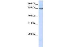 WB Suggested Anti-DCLRE1C Antibody Titration:  0. (DCLRE1C antibody  (C-Term))