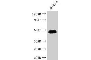 Western Blot Positive WB detected in: SH-SY5Y whole cell lysate All lanes: NADK antibody at 1. (NADK antibody  (AA 1-300))