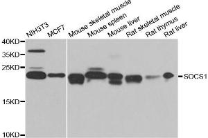 Western blot analysis of extracts of various cell lines, using SOCS1 antibody. (SOCS1 antibody)