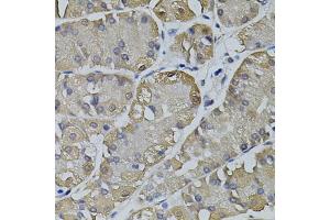 Immunohistochemistry of paraffin-embedded human stomach using TRPC3 antibody (ABIN5995383) (40x lens).