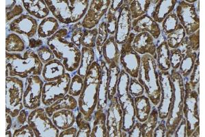 ABIN6272406 at 1/100 staining Rat kidney tissue by IHC-P. (RAB34 antibody  (Internal Region))