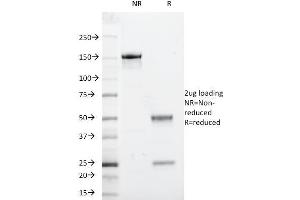 SDS-PAGE Analysis Purified Beta-2-Microglobulin Mouse Monoclonal Antibody (246-E9. (beta-2 Microglobulin antibody)