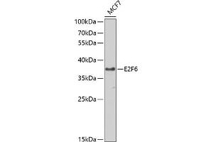 Western blot analysis of extracts of MCF-7 cells, using E2F6 antibody (ABIN1679632, ABIN1679631, ABIN5664137 and ABIN6219769) at 1:1000 dilution. (E2F6 antibody  (AA 1-281))
