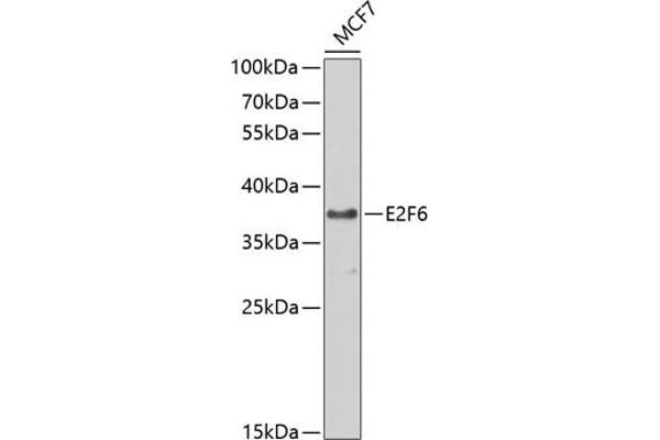E2F6 anticorps  (AA 1-281)